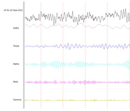 You are currently viewing Können EEG-Stirnbänder Meditation messen?